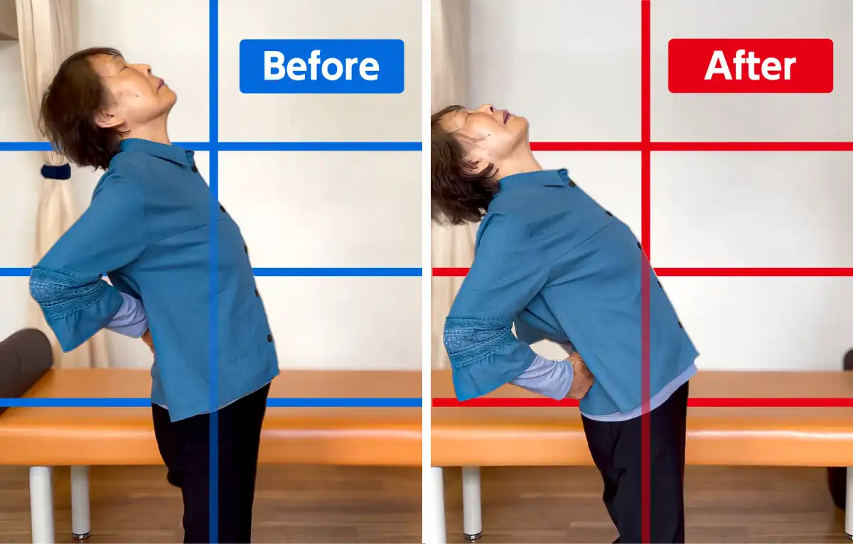 施術前と後の女性の背筋の反らし具合の比較写真。後の方がより反っている